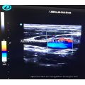 DW-C900 4D máquina de ultrasonido Doppler color con función de elastografía